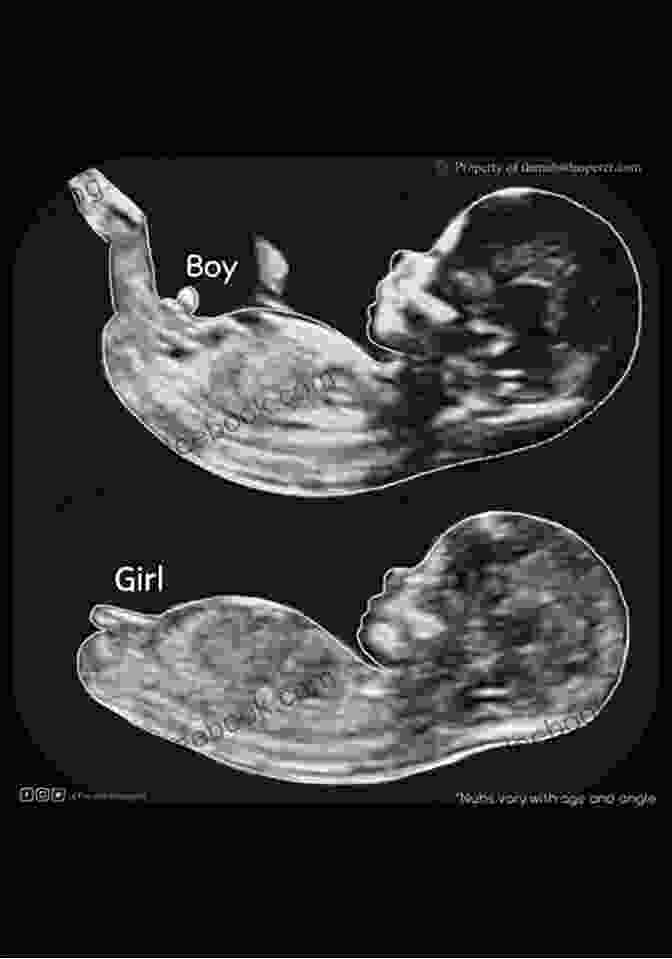 Baby Magic Motif Ultrasound Image Showing A Girl Motif Baby Magic Motif Boy Or Girl: Plastic Canvas Pattern