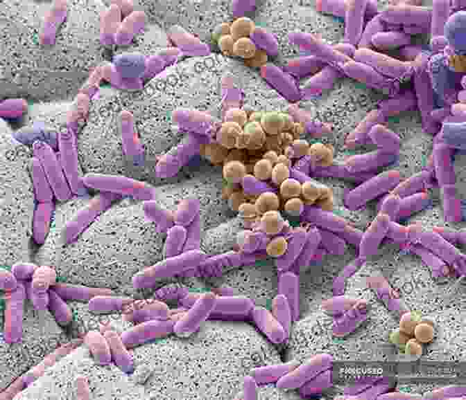 Microscopic Image Of Bacteria Did You Know This : Russia / Russia For Kids: About Russia For Kids Russia Country Russian People For Kids (Did You Know This?)