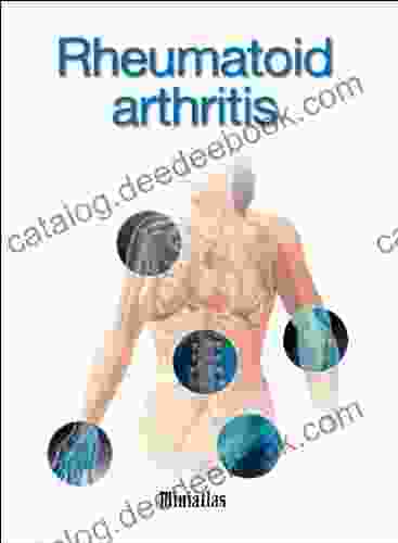 Rheumatoid Arthritis Miniatlas Glenn N Levine
